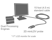 mse-system-2DminiLDV